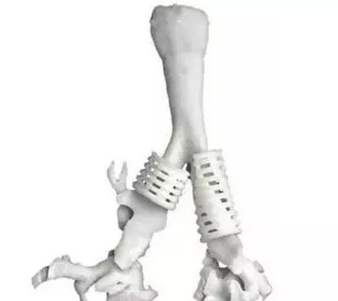 3D打印技術(shù)在植入式醫(yī)療器械中的應(yīng)用