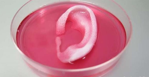 3D打印技術在植入式醫(yī)療器械中的應用