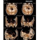 供應(yīng)利特爾噴墨膠片dm噴墨膠片