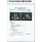 供應(yīng)恒興盛PET供應(yīng)激光打印醫(yī)用PET膠片